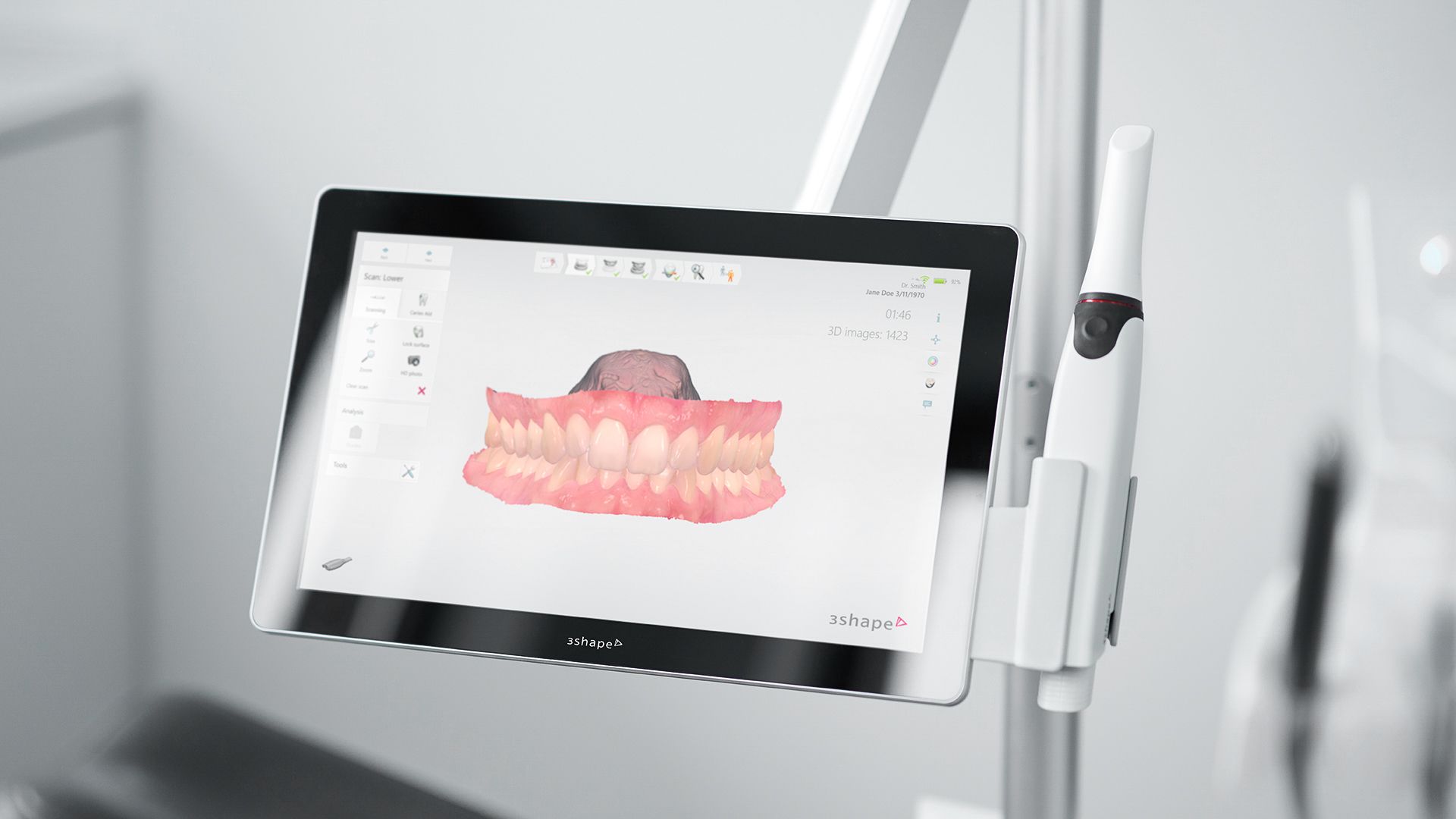 3Shape Intraoral Scanner  Dublin, CA